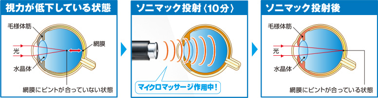 目に対する作用と安全性